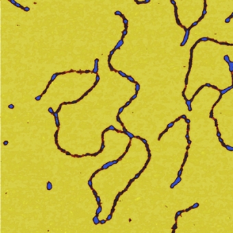 115_DNA Dalla serie Blow up. Immagini dal Nanomondo